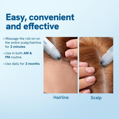 Bodywise Advanced Hair Growth Serum Roll On- For Hair Thinning, Herbal- (25ml)