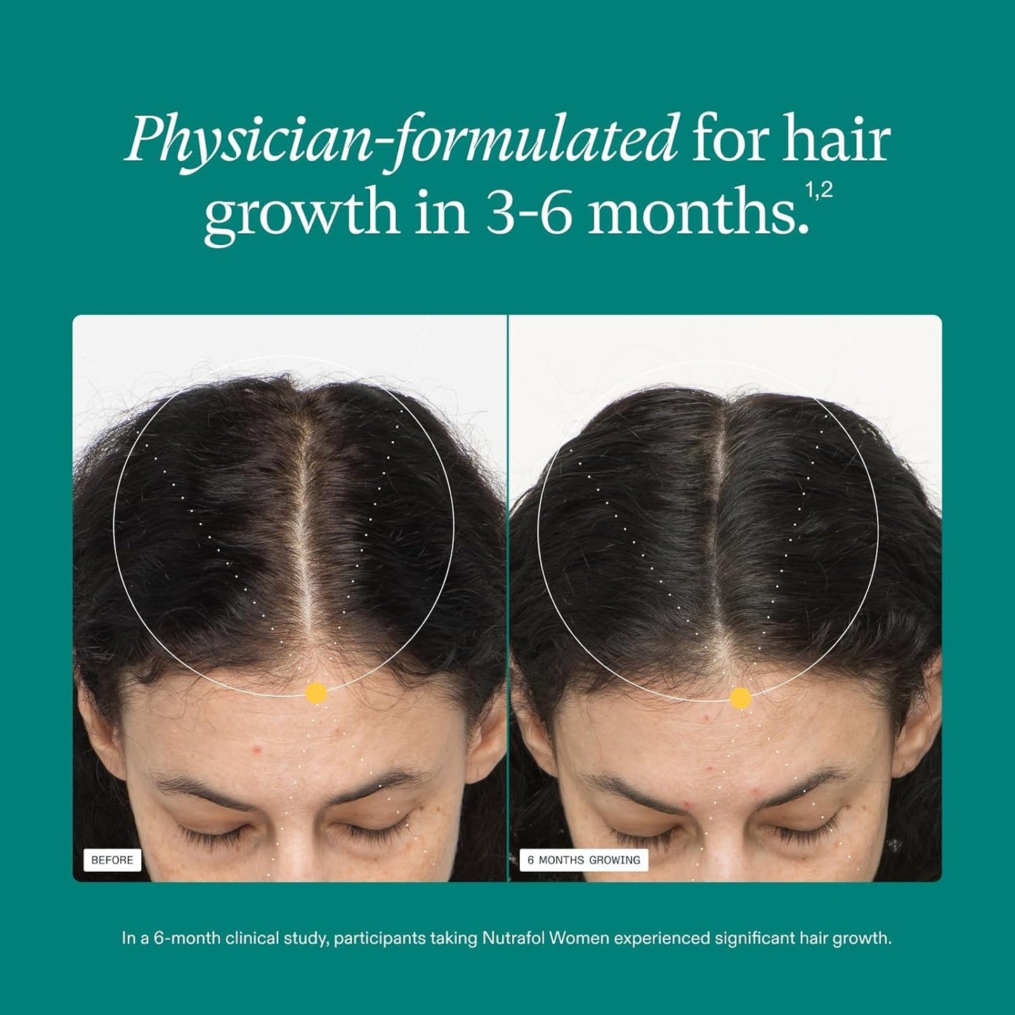 Nutrafol - Natural Hair Growth Formula - Women's Supplements - Thicker & Stronger Hair Support - Daily Use