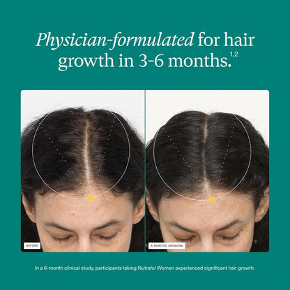 Nutrafol - Natural Hair Growth Formula - Women's Supplements - Thicker & Stronger Hair Support - Daily Use